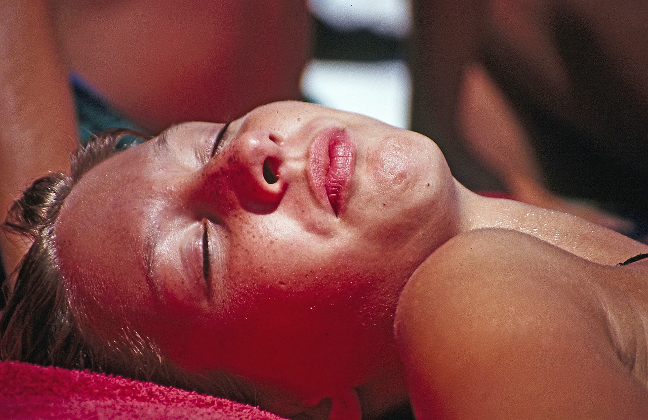 Skin sunburn in a woman face